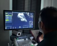 Bebeğin ilk kalp atışı ne zaman duyulur? Fetal kalp atışı kaçıncı haftada başlar?