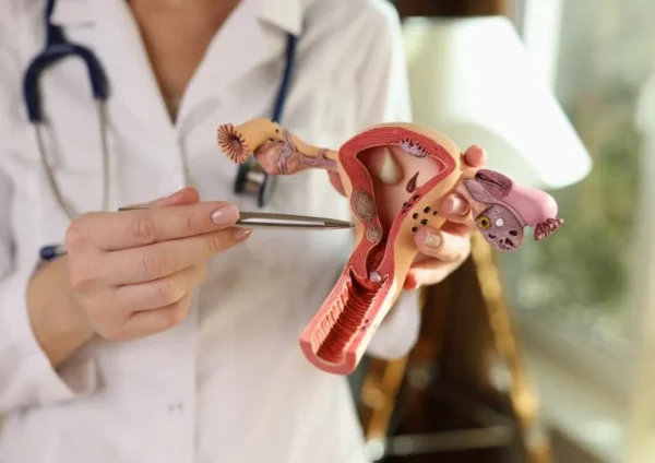 endometriozis-cikolata-kisti-nedir-endometriozis-cikolata-kisti-belirtileri-medical-park